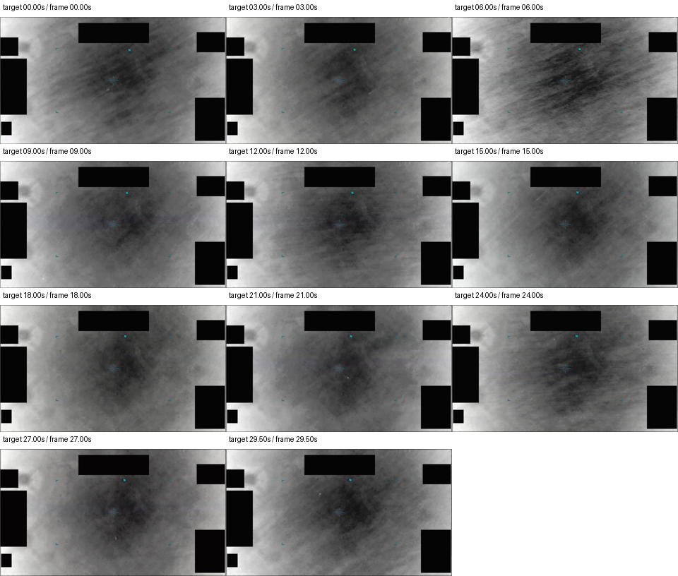 PR093 autocontrast review aid