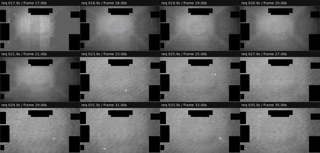 PR095 00:17-00:35 zoom and multiple-contrast window